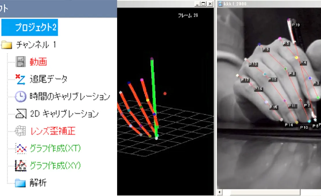 ツリー構造