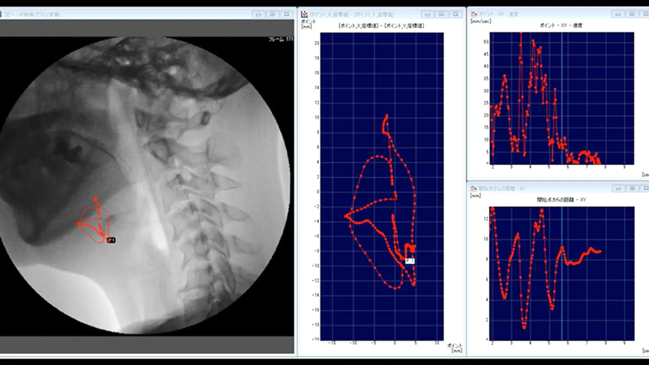 嚥下の運動解析の画像