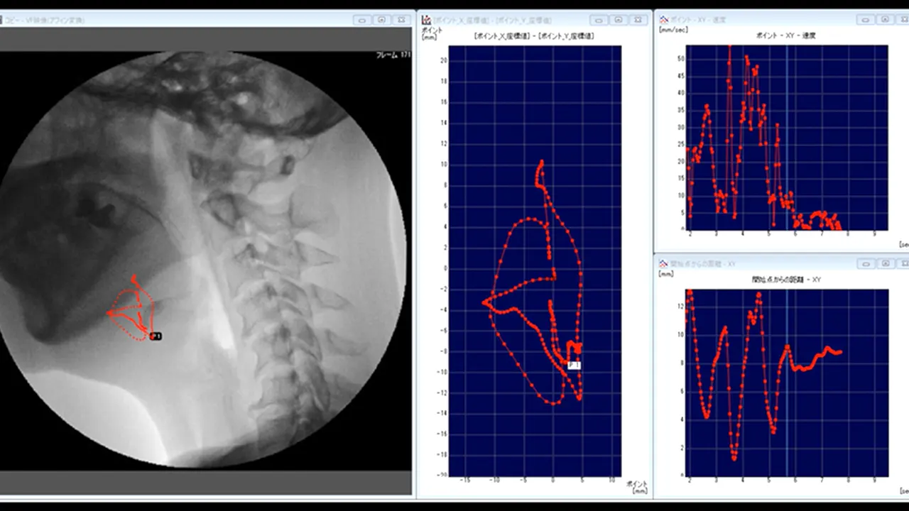 medical_visualization_運動解析_嚥下_V01