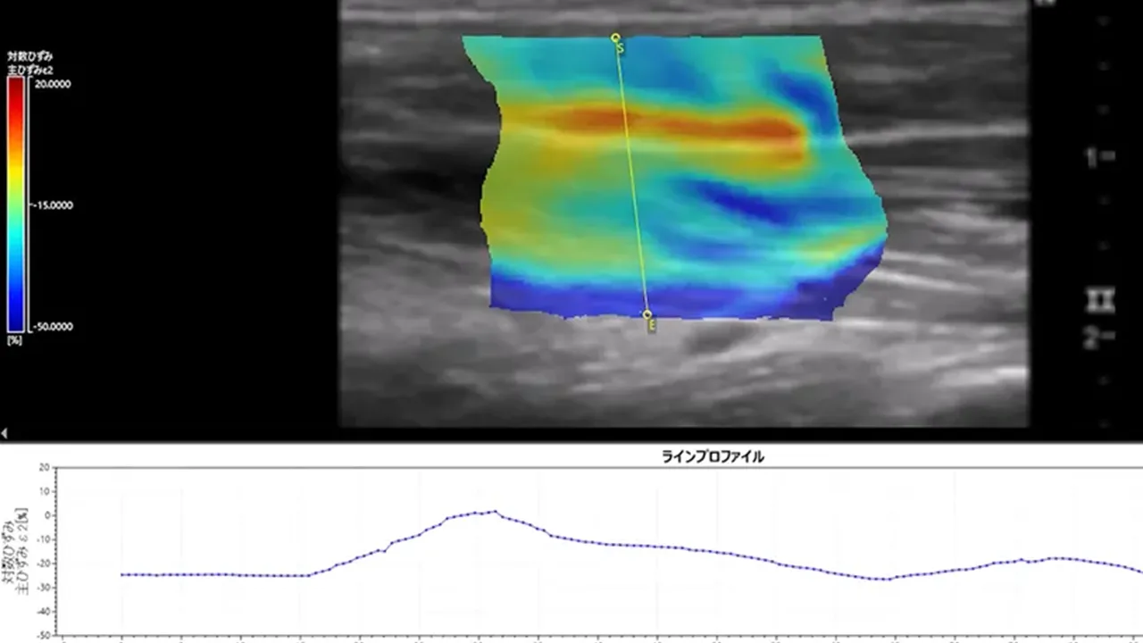 medical_visualization_DIC_エコー画像のひずみ_V01