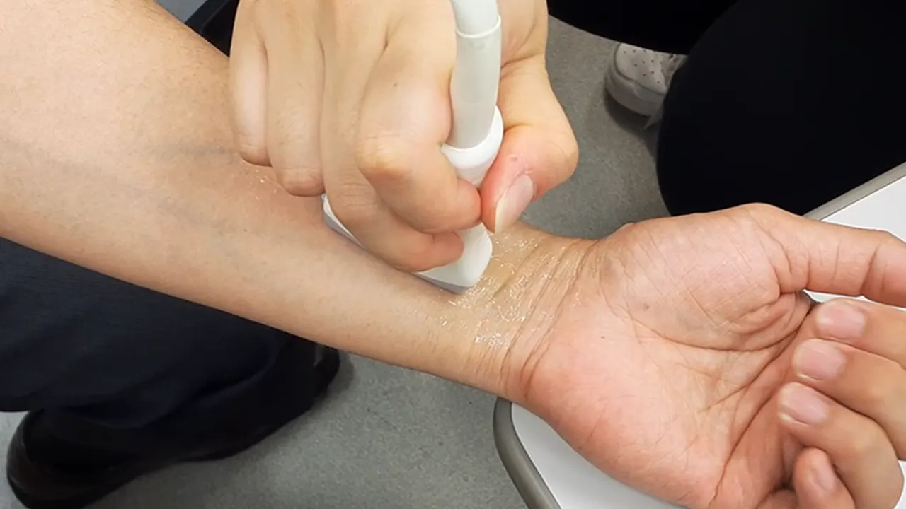 medical_visualization_DIC_手首_エコー_V01